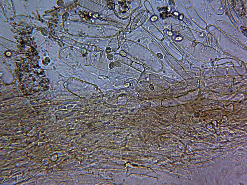 Armillaria mellea 16 - Cutícula x 400